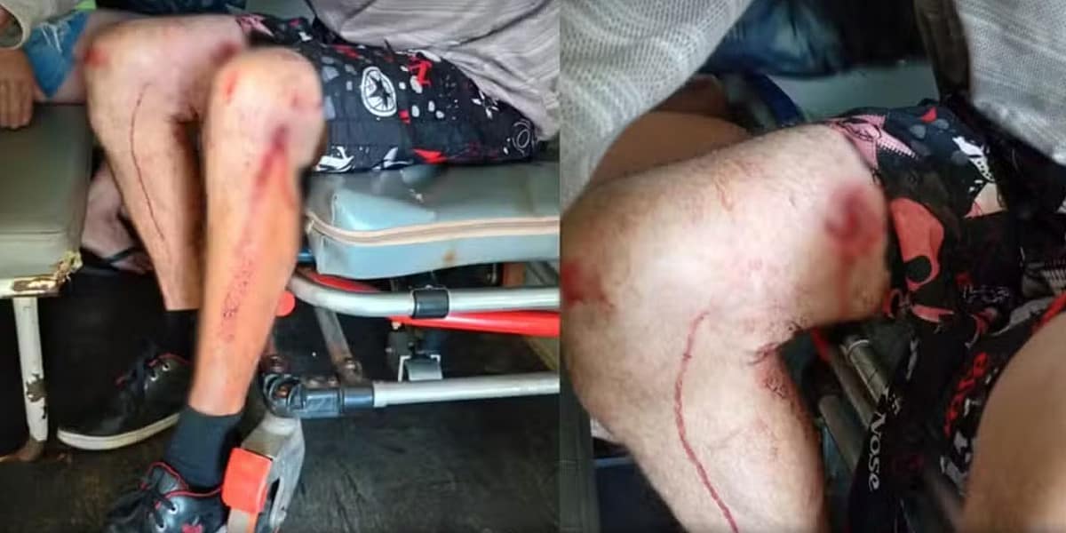 Idoso fica gravemente ferido após ataque de cachorro em Cesário Lange - Cidade em Cesário Lange